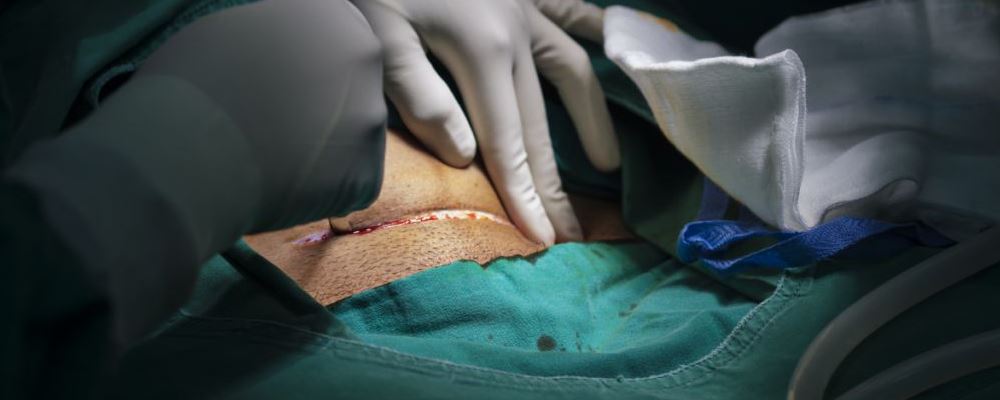 剖腹產(chǎn)后惡露不盡需要清宮嗎 不同情況不同處理