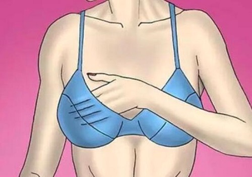 女性豐胸時需要注意什么 盤點女性豐胸的三個注意事項