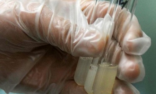 男性精液是否正常怎么判斷 本文分享8個(gè)方法判斷精液健康