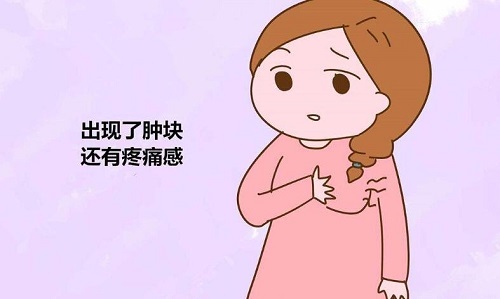 醫生用手捏了下說我乳腺增生 預防乳腺增生方法分享