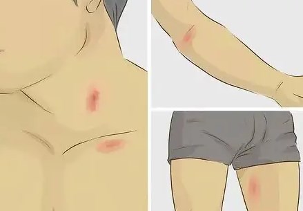 往胸上種草莓疼不疼 吸草莓的正確位置在哪里