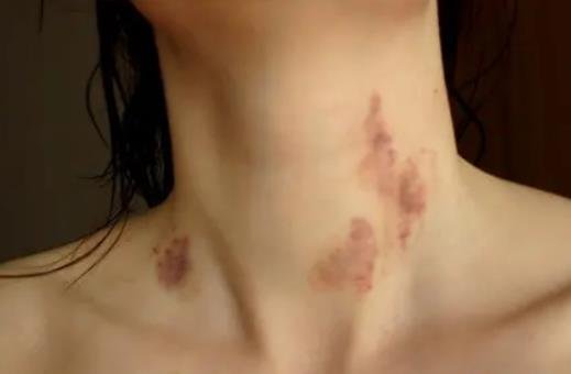 為什么不要吻男生脖子 親吻男生脖子有什么后果