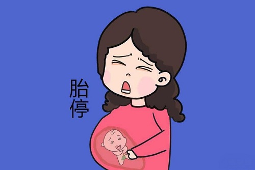 孕媽三個行為會引起胎停是什么 孕媽胎停會有哪些癥狀
