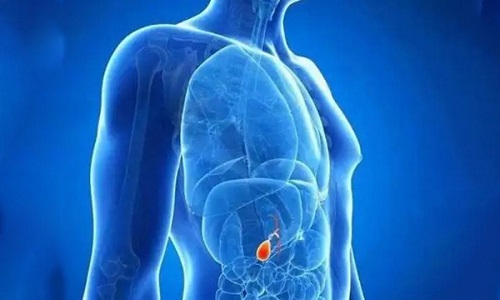 膽結石吃什么可以化掉結石 膽結石是怎么引起的原因