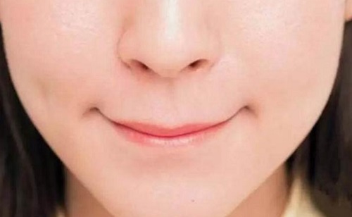 長期抿嘴會(huì)改善凸嘴嗎 嘴巴凸起怎么矯正