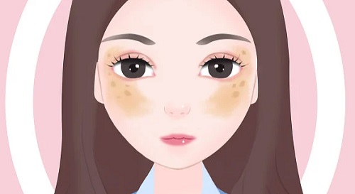 女人為什么會(huì)長黃褐斑 長了黃褐斑要注意哪些
