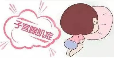 肌腺癥需要手術(shù)嗎 腺肌癥會癌變嗎
